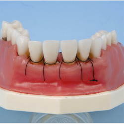 Periodontisk trningsmodel