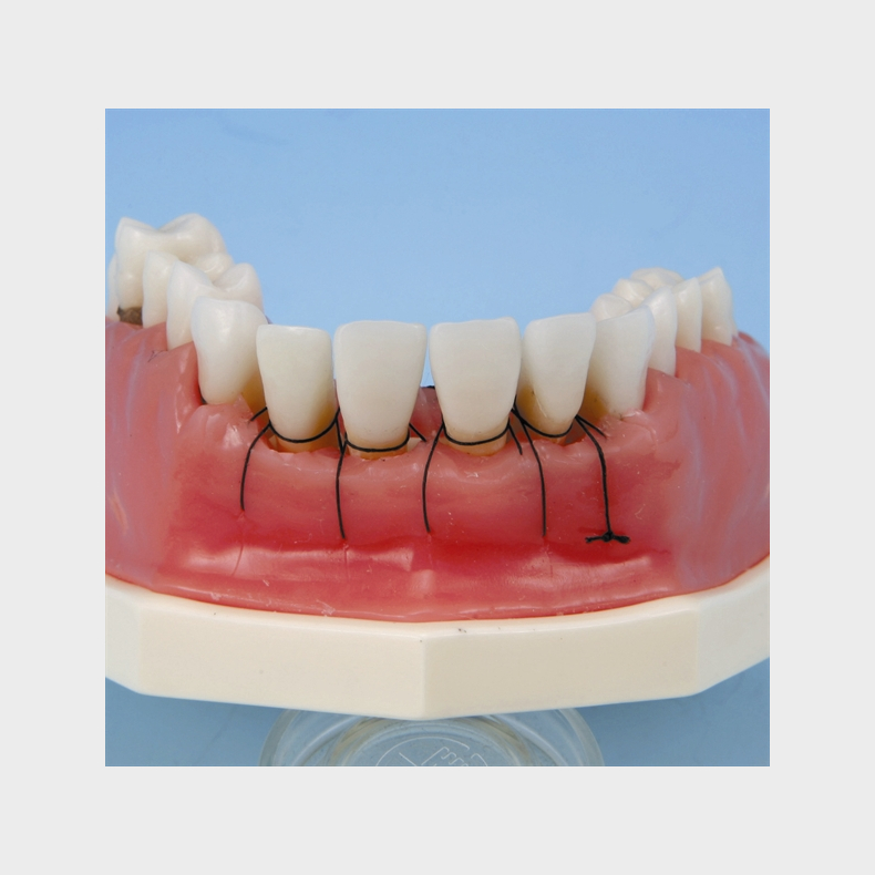 Periodontisk trningsmodel