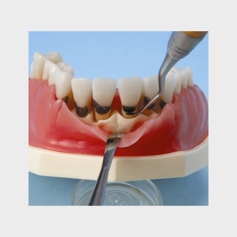 Periodontisk trningsmodel
