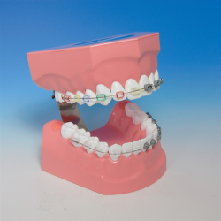 Ortodontisk model til demonstration af tandbrstning inkl. tandbrste 