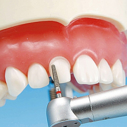 Protetisk &amp; restorativ trningsmodel