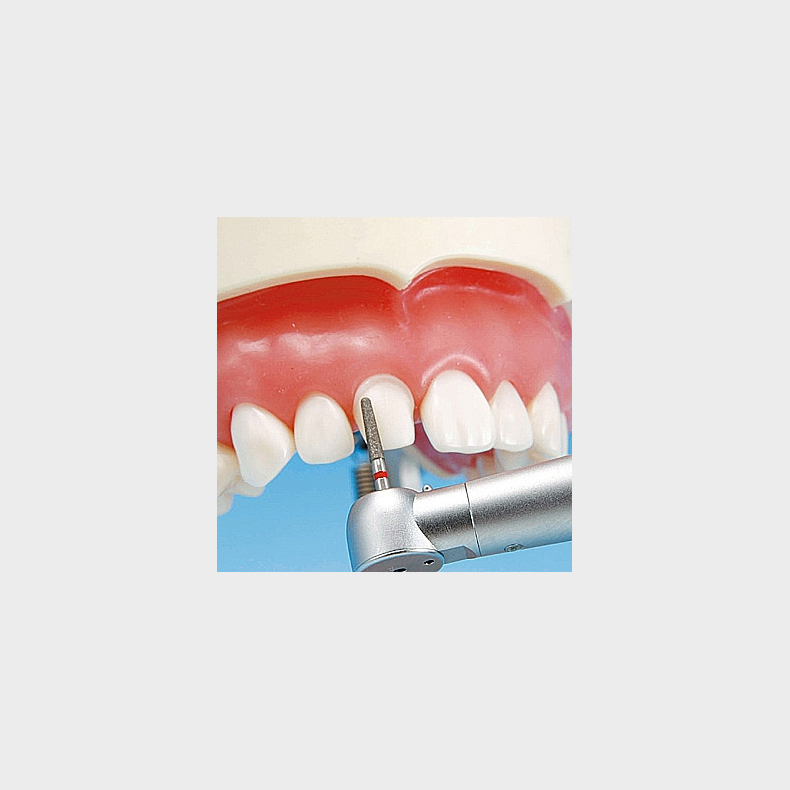 Protetisk &amp; restorativ trningsmodel