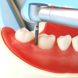 Protetisk &amp; restorativ trningsmodel