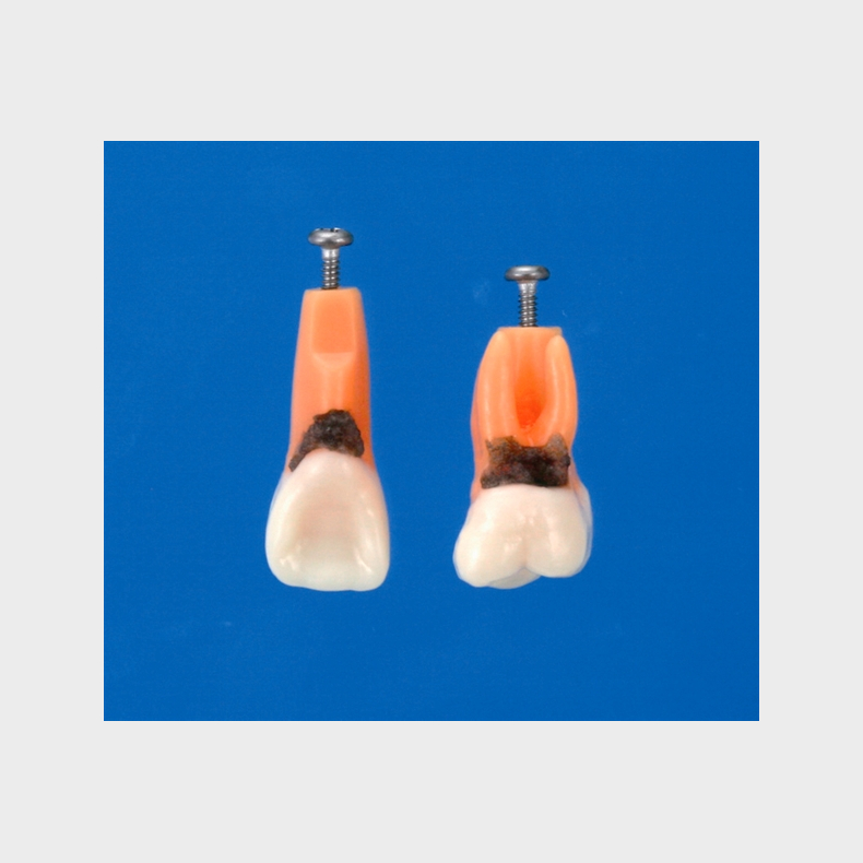 Model til trning af parodontale behandlingsteknikker 