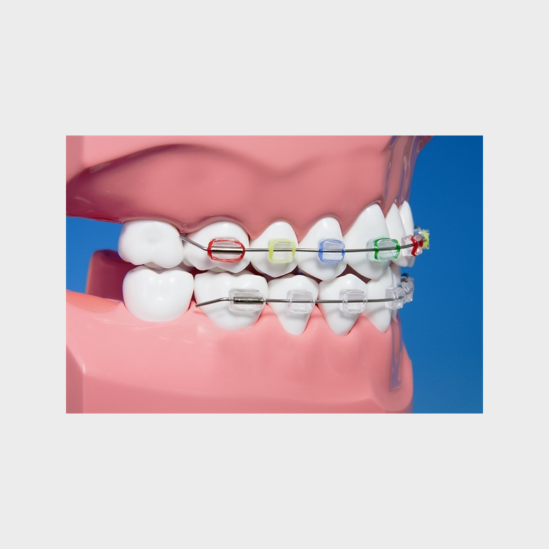 Ortodontisk model til demonstration af tandbrstning inkl. tandbrste 