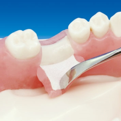 Basic Implantat Trningsmodel 