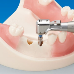 Basic Implantat Trningsmodel 