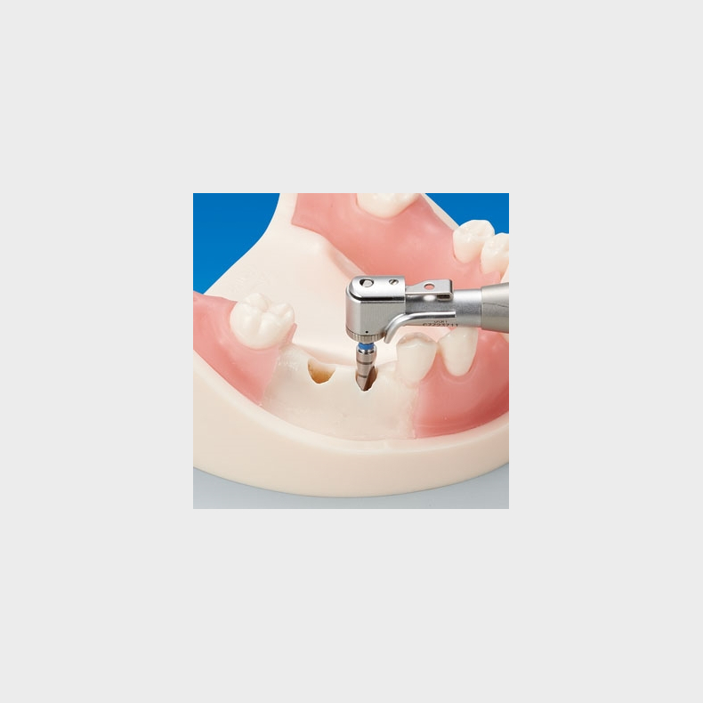 Basic Implantat Trningsmodel 