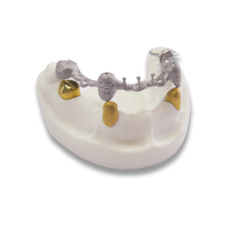 E-lringskursus: Teleskopproteser