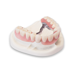 E-lringskursus: Teleskopproteser